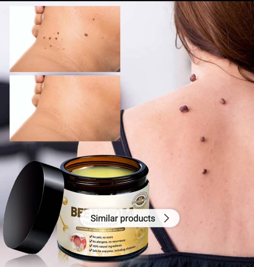 Crème de Traitement Bee Venom – Soulage les Douleurs Articulaires Naturellement & Efficacement